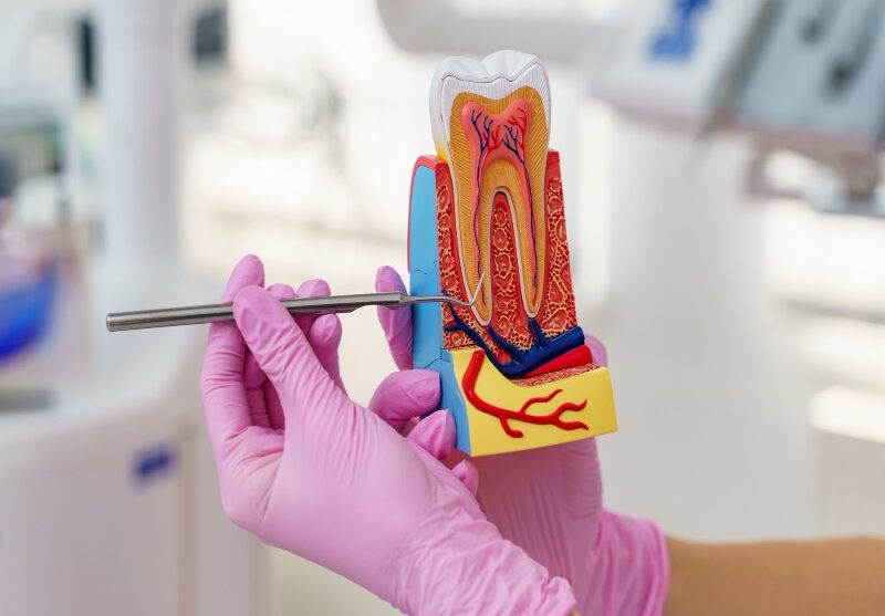 Root Canal Treatment